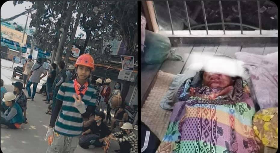 One youth got killed with the bullet round in the eye and neck during the brutal crackdown in Sheepyithar, Yangon!Myanmar Military Terrorists killed him!He was still a 17-year-old boy.
LOCOMOTIVE XYZ
#WhatsHappeningInMyanmar
#Mar14Coup