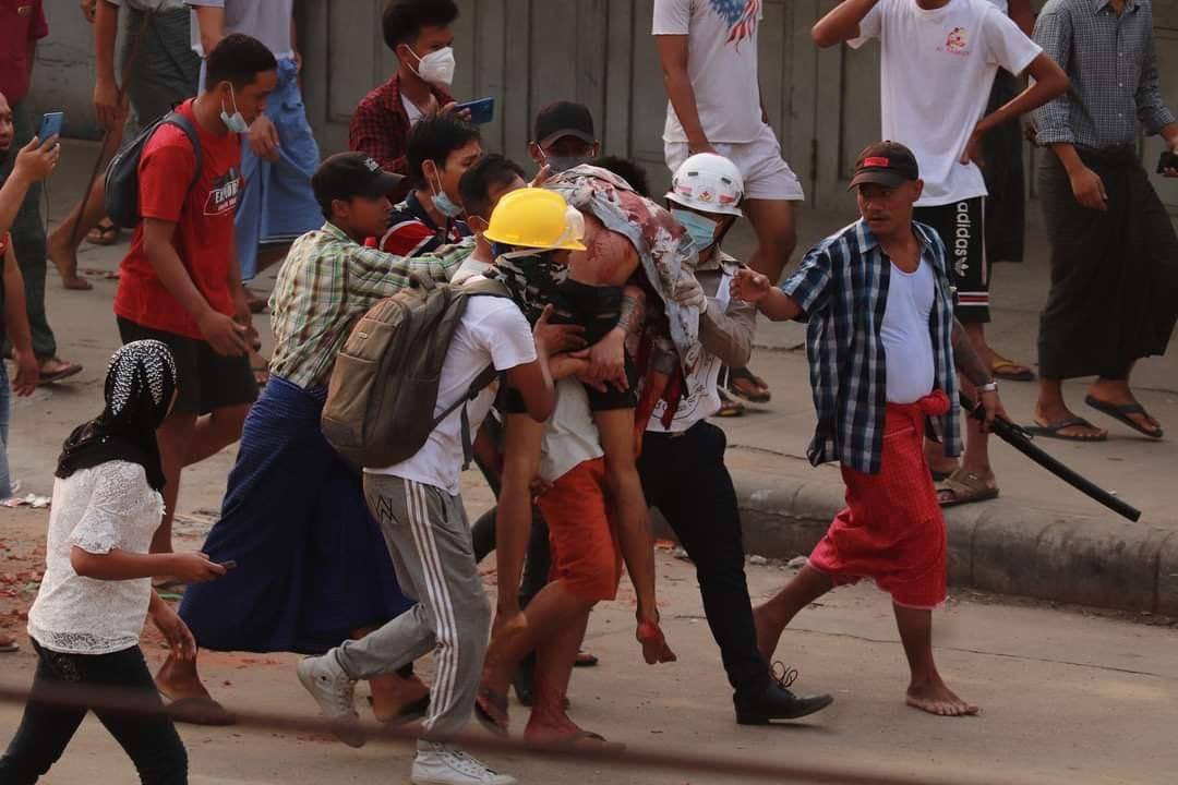 📍Yangon, Myanmar
tw//blood 
In Phayar Road, ThinGanGyun, Yangon, one was shot to death with live ammunition by terrorists. We are losing so many lives all over Myanmar.
LOCOMOTIVE XYZ
#WhatsHappeningInMyanmar
#Mar14Coup