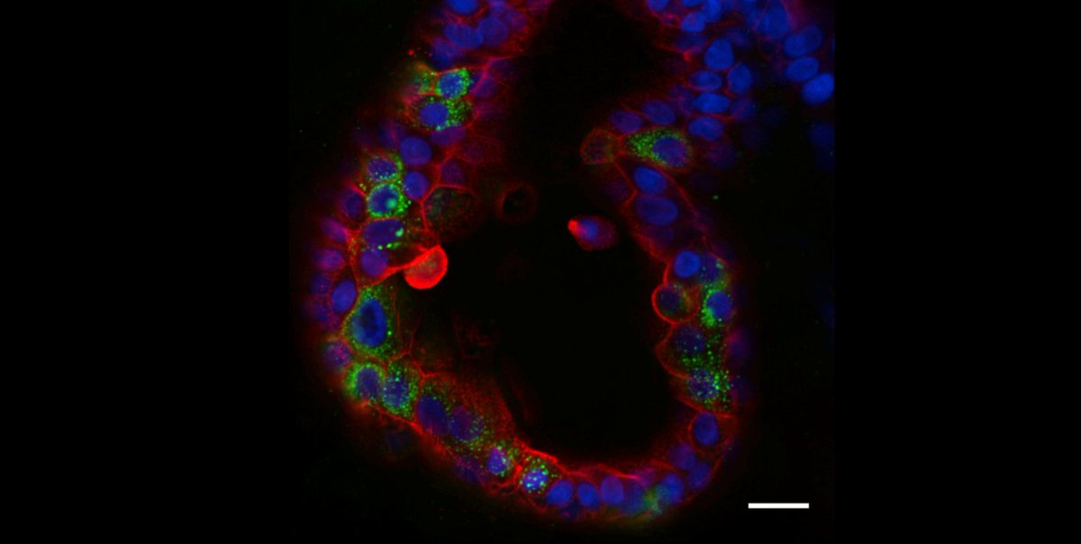 organoidscience's tweet photo. #Organoids are emerging as versatile tools to progress the understanding of #SARS-CoV-2 biology and to aid in the quest for novel treatments. 

Read more from Dr. @HansClevers in @stemcellreports here:
https://t.co/jnWBQfgX9k https://t.co/VIMiLYqkjl