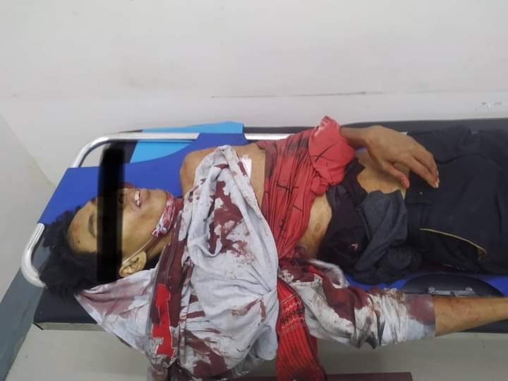 In Thingangyun Township,Yangon, 
At least five protestors were injured.Terrorists are deployed at the top of AKK shopping mall and shot with snipers.

LOCOMOTIVE XYZ
#WhatsHappeningInMyanmar
#Mar14Coup
