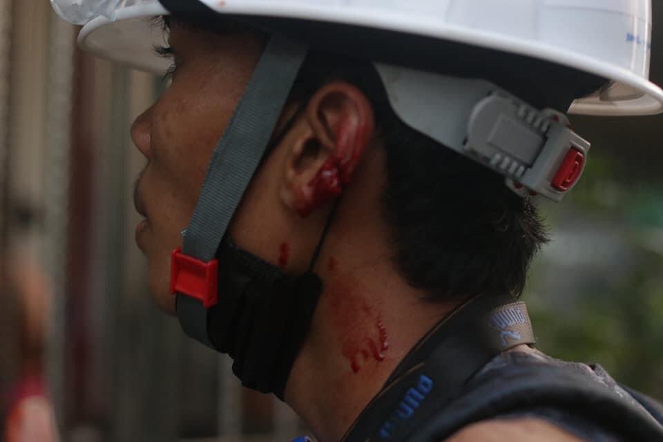 MilkTeaMM_MTAM's tweet photo. Terrorists doing mass-killing in yhe whole Yangon. Also in South-Oakkalapa📍,Terrorists set fire to barricades,shot at many citizens(one in Abdomen is in critical condition,one in leg &amp; one in head) at around 6PM. #WhatsHappeningInMyanmar #Mar14Coup #MilkTeaAlliance https://t.co/7B28bCvZSD