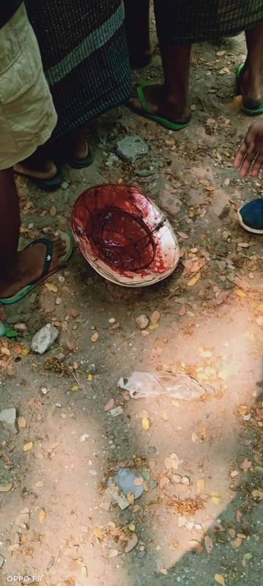 Tw // death // blood

More than 7 killed by Military attackers in Hlaing Thar Yar; At least 40 were bloodily wounded due to gunshot on Mar 14 as soldiers opened fire to suppress peaceful protests against last month Coup.

LOCOMOTIVE XYZ
#Mar14Coup
#WhatsHappeningInMyanmar