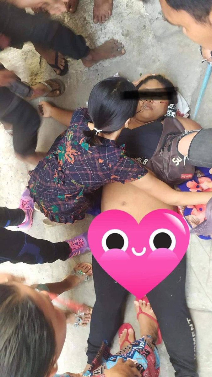 Kid_000_'s tweet photo. tw // blood // death 
One female was heatshot to dead in Mandalay with live ammunition by terrorists. At least 6 people were injured already by 6pm in Mandalay.
LOCOMOTIVE XYZ
#WhatsHappeningInMyanmar
#Mar14Coup https://t.co/eGSU51G052