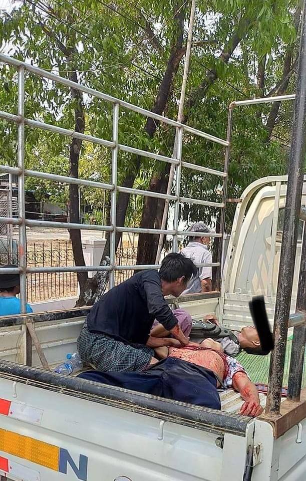 heunoia2's tweet photo. TW // blood 
In HlaingTharYar, Yangon, two more men were shot by live ammunition again. We are losing a lot of precious lives.
LOCOMOTIVE XYZ
#WhatsHappeningInMyanmar
#Mar14Coup https://t.co/BDeChvqHb0
