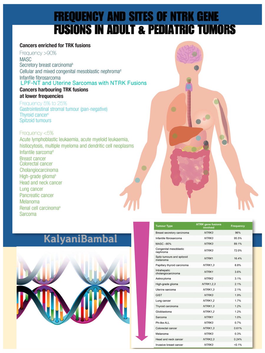 kriyer68's tweet photo. ON THE “TRACK”OF NTRK FUSIONS IN HUMAN TUMORS.
A tweetorial comprising some handouts I made as a contribution to #Pathbracket 
#pathology #molpath #molgen #oncology #residents
@smlungpathguy @JMGardnerMD @LizMontgomeryMD @Sinchita_Roy @kanagalshamanna @MoPathGuy @RunjanChetty https://t.co/qH6Gc9D4Q7