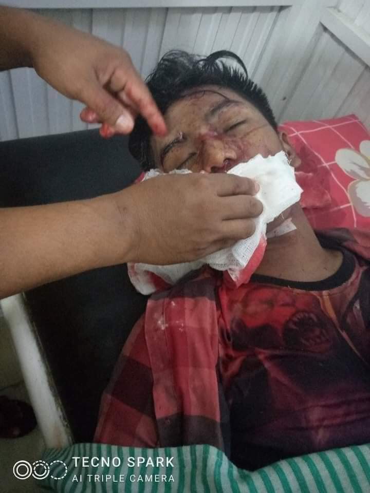 SeemlyOf's tweet photo. Mass Shooting in Shwe Pyi Thar; As Junta’s Military dogs escalated planned killings during breaking up protest crowds, 2 were Killed n 5  got bloodily gunshot wounds due to live ammunitions.

LOCOMOTIVE XYZ
#Mar14Coup
#WhatsHappeningInMyanmar
@YourAnonCentral @UN_HRC https://t.co/dkjLVh1b5C