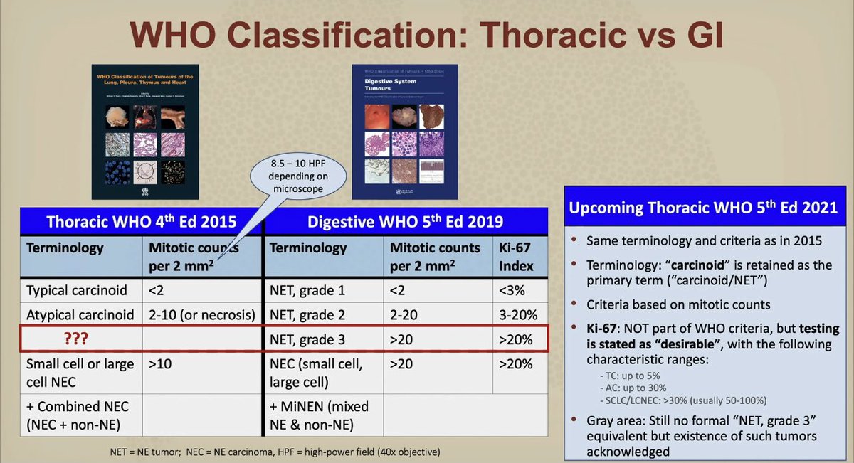 #SundayMorning coffee and #USCAP2021 #USCAP2021VNI <a href="/lung/">lung</a> neuroendocrine tumors! By <a href="/natasharekhtman/">Natasha Rekhtman MD PhD</a> ! So well versed and helpful! Thank you!