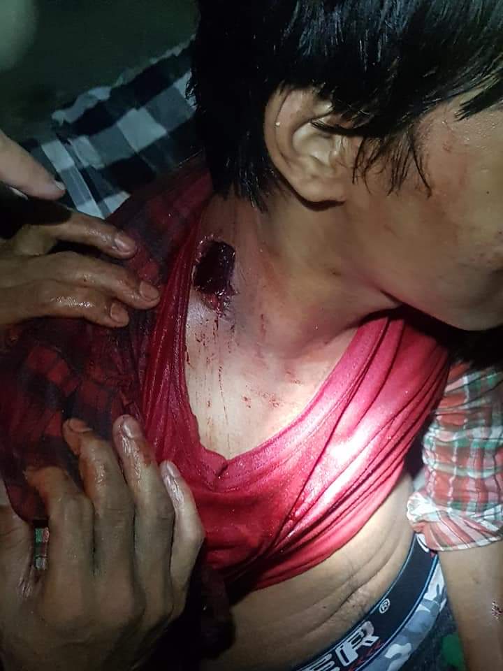Happening in North Dagon township ,Yangon.
Violent crack-down , many of the civilian were got gunshot.
One got at Neck.
Tw // Gunshots // wound
#Mar14Coup
#WhatsHappeningInMyanmar