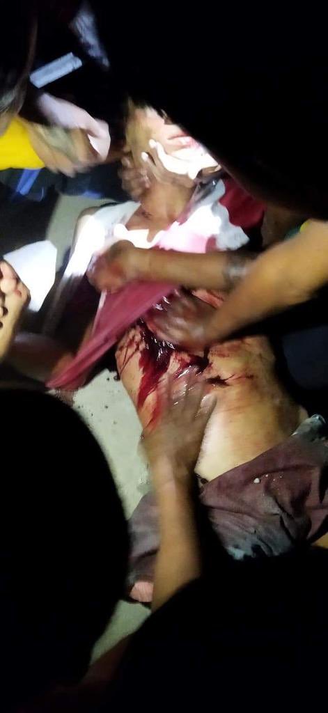YanonePhue's tweet photo. Tw // blood // gunshot wound 

In NorthDagon Town, Yangon, civilians are being shot with real bullets. 
Happened around 7:30p.m. 

LOCOMOTIVE XYZ
#Mar14Coup
#WhatsHappeningInMyanmar https://t.co/oa9sdcg8NM