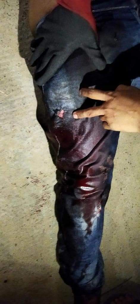 ZuMerryByun's tweet photo. Happening now in North Dagon,
Yangon;

Reportedly 5 people were shot with live ammunition  by junta n shot casualties could increase.Local said they cut off the light and then start shooting.

LOCOMOTIVE XYZ
#WhatsHappeningInMyanmar 
#Mar14Coup https://t.co/9Cmdrg1ypV