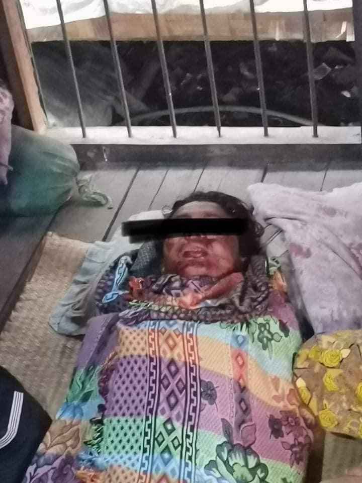MilkTeaMM_MTAM's tweet photo. tw //death ! Brave 17-yr boy who even left school after his father passed away,working for the living of his sister&amp;brother.He was now shot to death in his eyes&amp;tight. Terrorists killing innocent lives. Rest in Power brave boy.
#WhatsHappeningInMyanmar
#Mar14Coup https://t.co/9kU7Hww85K