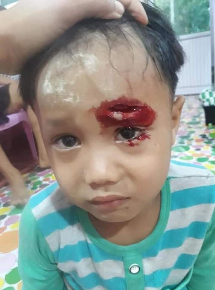 Even in the war, there is no chance to shot the children. Now look at what's happening in Myanmar. The Military killed the people intentionally.
#WhatsHappeninglnMyanmar 
#SaveMyanmar