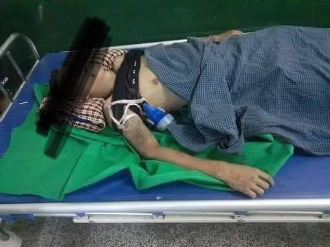 tw // blood // death 
In Thingangyun,Yangon,One in the head,One in the hand,One in the lips,one in the chest near heart,one in the abdomen.At least 25 got shot and 7 passed away reportedly.Death toll could be increased.
#WhatsHappeningInMyanmar
#Mar14Coup
