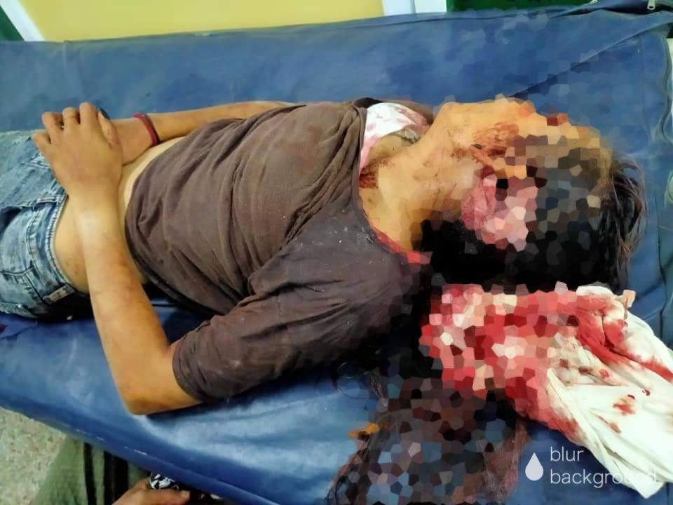 tw // blood // death 
In South Dagon, Yangon, terrorists shoot purposely aiming the head of a 15 years old girl.
LOCOMOTIVE XYZ
#WhatsHappeningInMyanmar
#Mar14Coup