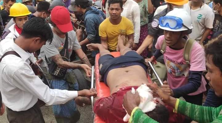 SoeSoe70443625's tweet photo. Military armed group shoot the cvilians with real bullets. Several media outlets confirmed there might be at least 30 deaths and dozens injured today, Mar 14. 

#WhatsHappeningInMyanmar
#MilitaryCoupInMyanmar
#CrimesAgainstHumanity
#Mar14Coup https://t.co/H3ie7w9GFW