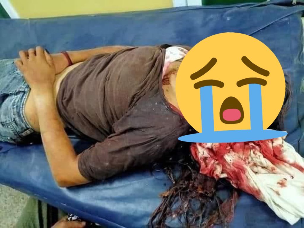 Lily_Moon9202's tweet photo. At South Dagon,
About 20 including 15 yrs old underaged girl who got shot in the head were shot and severely injured!
Terrorists kept using machines guns since evening and injured citizen numbers became more and more
@shafiur @poppymcp 
#WhatsHappeningInMyanmar 
#Mar14Coup https://t.co/V9N4eFqgAg