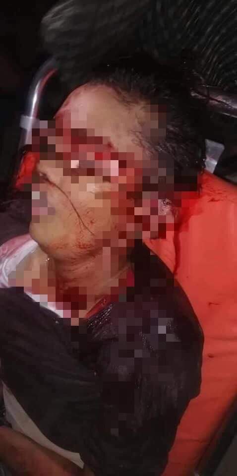 KhinThiriAung13's tweet photo. On Mar14,In hours of shooting in South Dagon township,Yangon,a 15 years old Young girl was  weighed straight on her head and shot dead by the TERRORISTS under the order of Junta.
#Mar14Coup 
#WhatsHappeningInMyanmar https://t.co/5oYu1KuRod