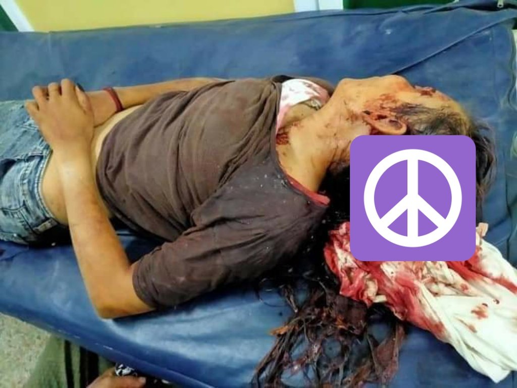 phyonilarkyaw's tweet photo. A 15yrs old local girl protester got headshot during the military crackdown in South Dagon, Yangon tonight. Hospital emergency dept. are getting overloaded with the injured protesters. A YGH doctor said there are still lots of critical cases.
#Mar14Coup 
#WhatsHappeningInMyanmar https://t.co/cukkoVPXIF