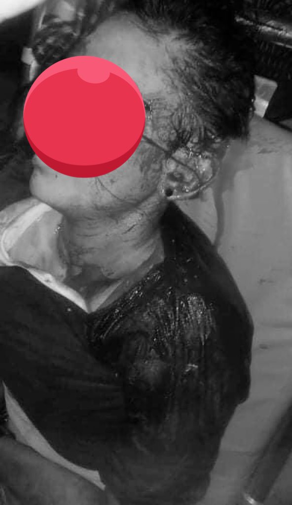 Hninthu7's tweet photo. Tonight,15 years old girl was killed by military terrorists in South Dagon township with gunshot wound head
Our day and night are like in hell
#WhatsHappeningInMyanmar 
#Mar14Coup https://t.co/HEp8MfoWoz