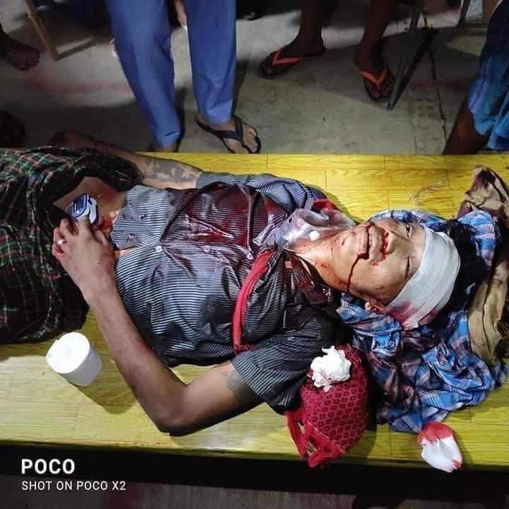 AungEleanor's tweet photo. @G7 @MathiasCormann @OECD #SouthDagon Yangon
Death 3 people
Hurt above 70 people
Why? They shot. We just request Democarcy and the Truth.

#HearTheVoiceOfMyanmar 
#WhatsHappeningInMyanmar 
#Mar14Coup https://t.co/DXVAA7FwDQ