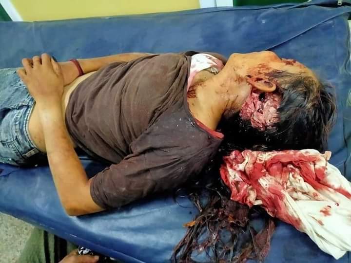 AungEleanor's tweet photo. @G7 @MathiasCormann @OECD #SouthDagon Yangon
Death 3 people
Hurt above 70 people
Why? They shot. We just request Democarcy and the Truth.

#HearTheVoiceOfMyanmar 
#WhatsHappeningInMyanmar 
#Mar14Coup https://t.co/DXVAA7FwDQ