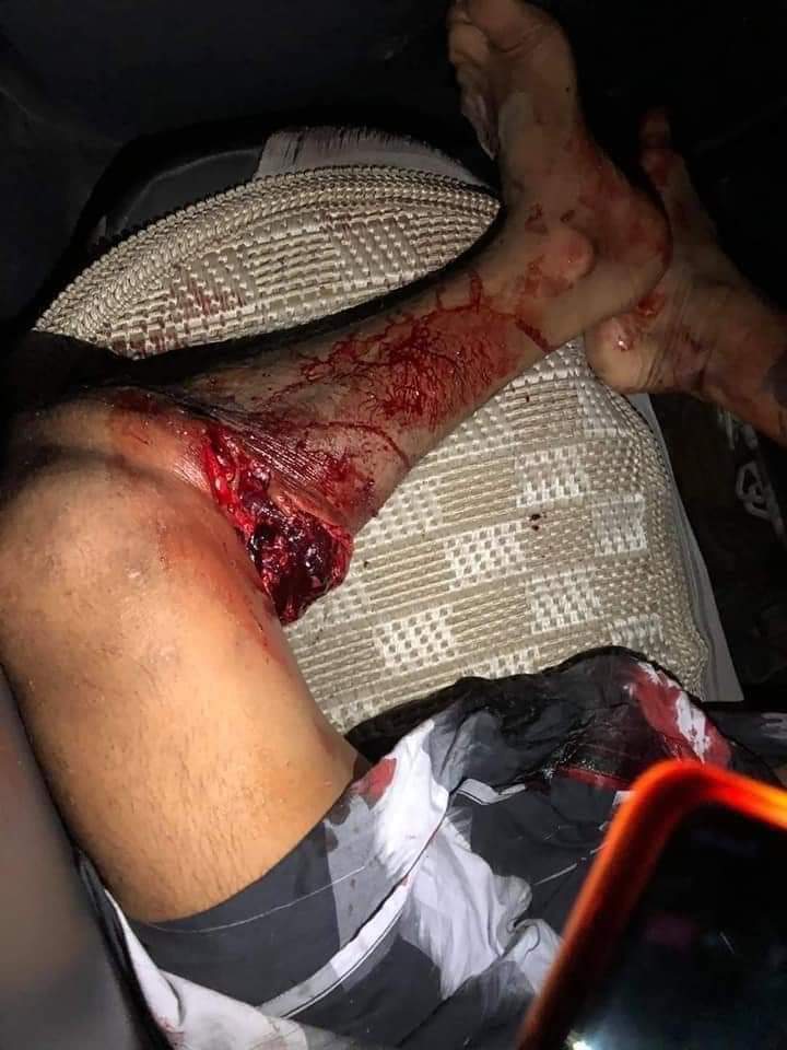 AungEleanor's tweet photo. @BWoodward_UN @antonioguterres @tariqahmadbt @WFPChief @Gabucher @USUN @NickDyerFCDO #SouthDagon Yangon
Death 3 people
Hurt above 70 people
Why? They shot. We just request Democarcy and the Truth.

#HearTheVoiceOfMyanmar 
#WhatsHappeningInMyanmar 
#Mar14Coup https://t.co/ZeKovCq6Qp