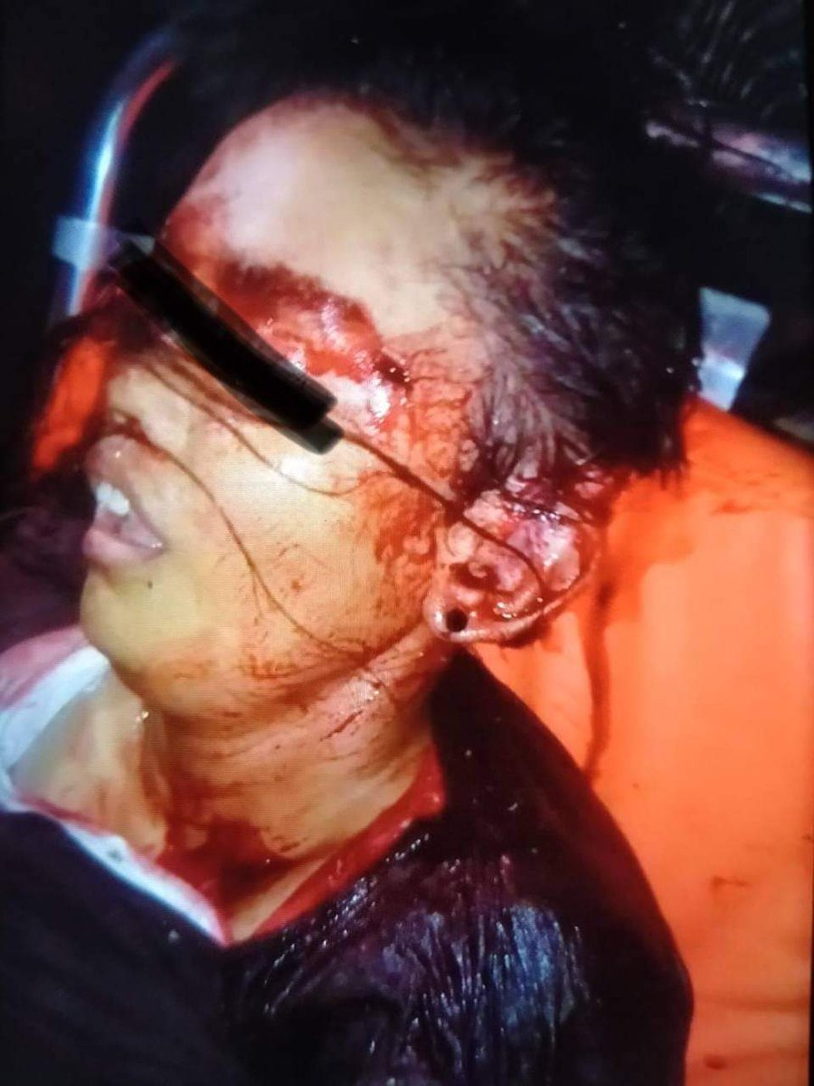 At 55th street,SouthDagon Township,Yangon, 2 civilians got shot with real bullets, one to the head(slide shot) and one to the chest.The other got shot to the head with rubber bullet. 
Happened around 7:30p.m
#WhatsHappeningInMyanmar 
#Mar14Coup
