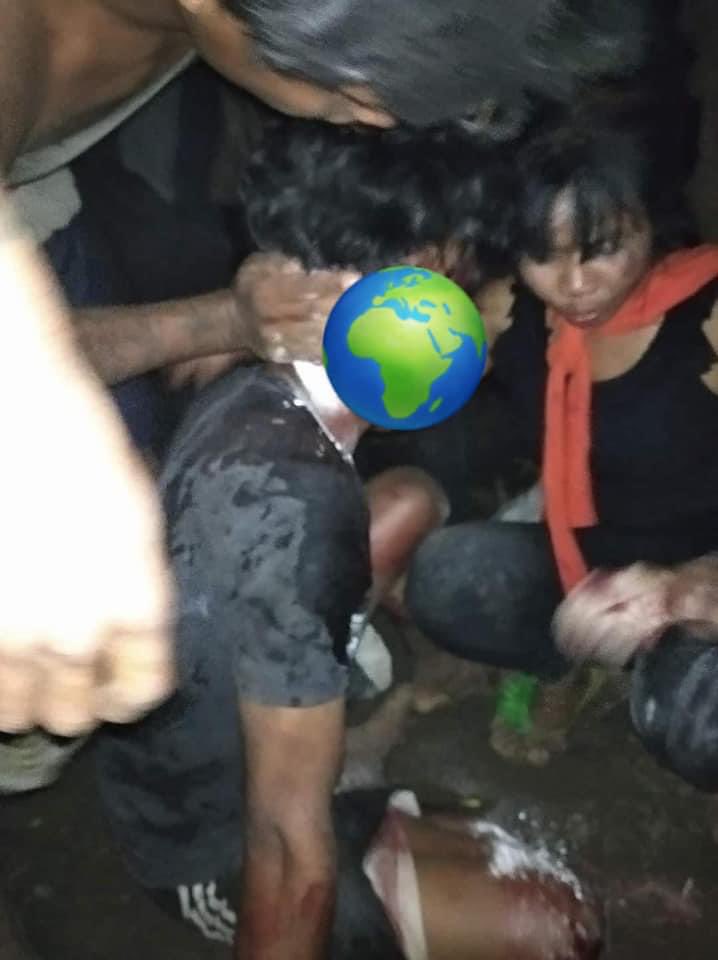 #Mar14Coup
Updated!
tw // blood
Myanmar Military Terrorists blocking the roads in Pathein and deploying since the night strike crackdown!Continuous crackdown using live bullets happening till 12pm!A lot of injuried residents are trapped inside!
#WhatsHappeningInMyanmar