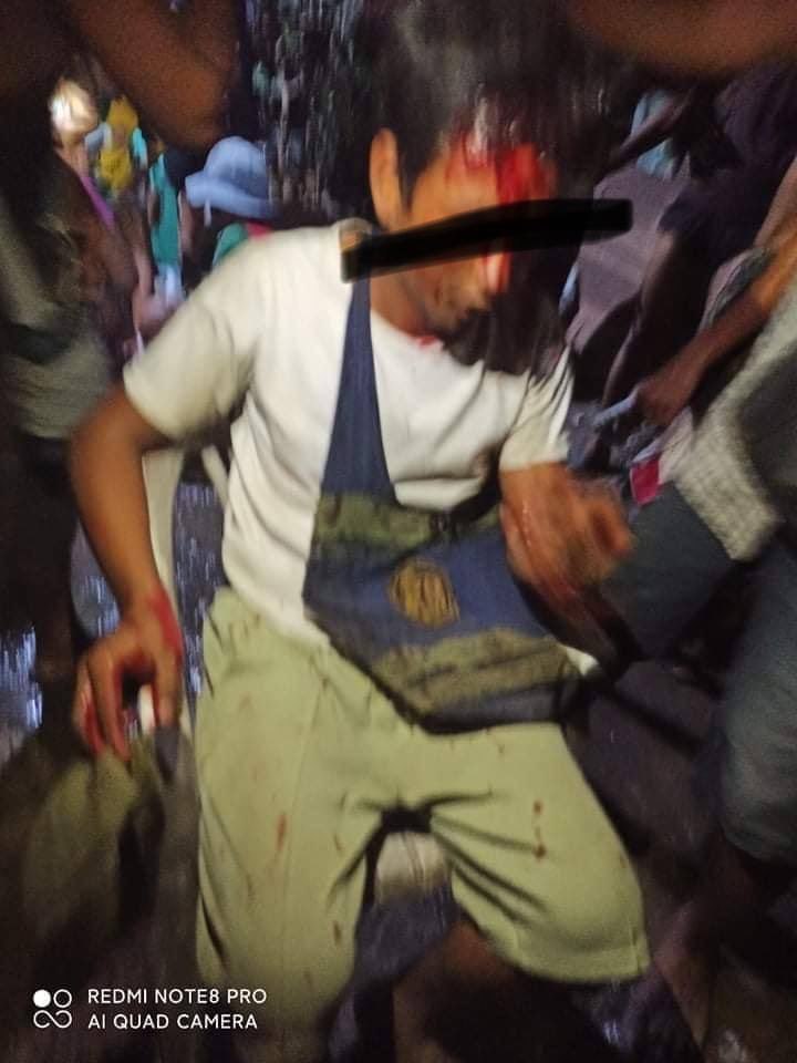 #Mar14Coup
tw // blood // death 
In south Dagon,Yangon,Terrorists use both machine gun and snipers.Electricity cut off and they shot civilians continuously.30 got shot and three passed away.
LOCOMOTIVE XYZ
#WhatsHappeningInMyanmar
#Mar14Coup