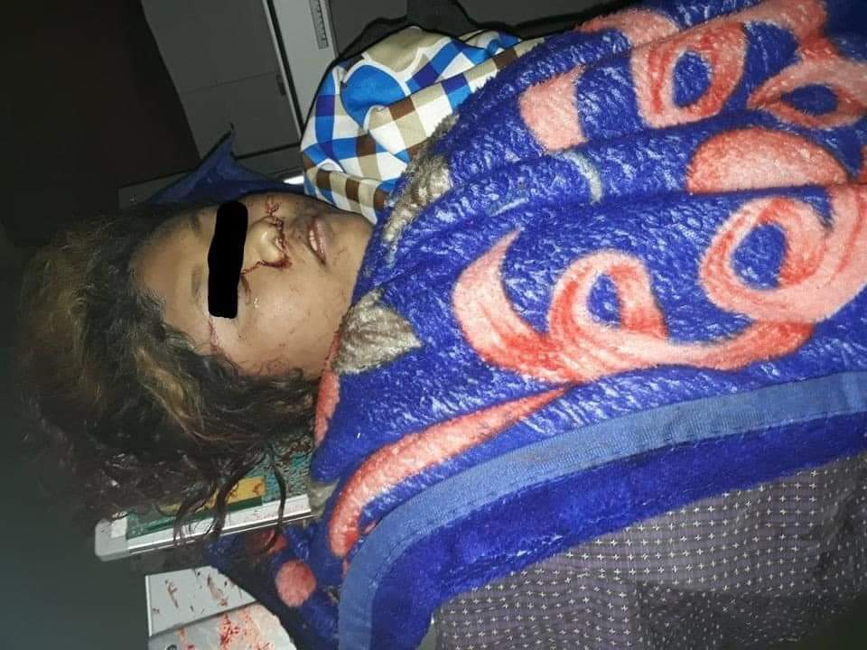 Bobabewww's tweet photo. Tw // death

In Mandalay, 86x42st, a woman got gunshot from terrorists and confirmedly dead. At least another 6 peaceful protestors injured.
LOCOMOTIVE XYZ 
#WhatsHappeningInMyanmar  #Mar14Coup  Ctto-https://t.co/GTAKJ7hgBd https://t.co/ArQfoNhukZ