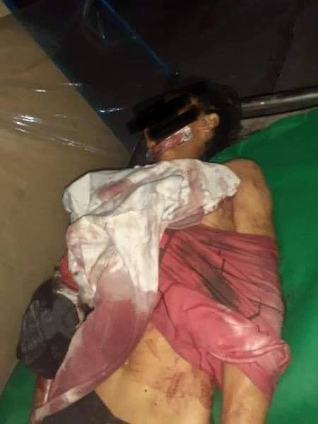 loon2262005's tweet photo. tw // blood // death 
In Thingangyun, Yangon, one was shot in the head, one in hand, one on  mouth, one at chest near heart and one to abdomen. At least 25 got shot and 7 passed away reportedly. Death toll could be increased.
LOCOMOTIVE XYZ
#WhatsHappeningInMyanmar
#Mar14Coup https://t.co/TzLrggWvm6