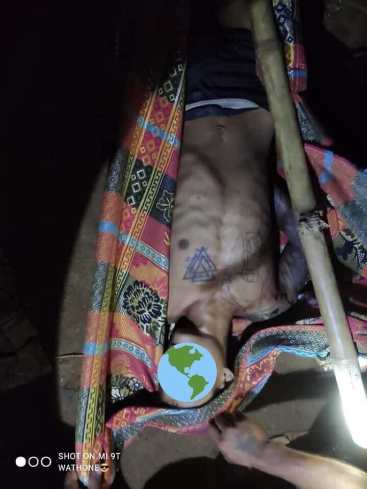 tw // blood , death

A protestor pass away due to the real bullet shot of terrorists gun in Pathein night strike.

#WhatsHappeningInMyanmar  #Mar14Coup