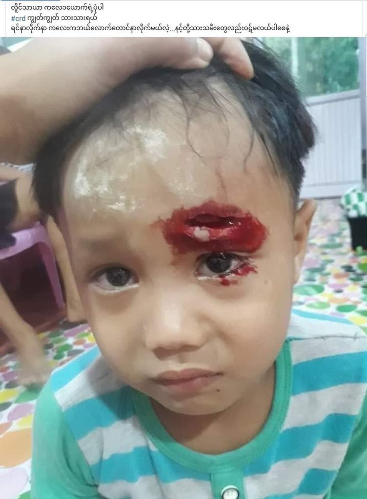 They shot even a kid at Hlaing Thar Yar. Kids are not safe at all !!!!#WhatsHappeningInMyanmar #Mar14Coup