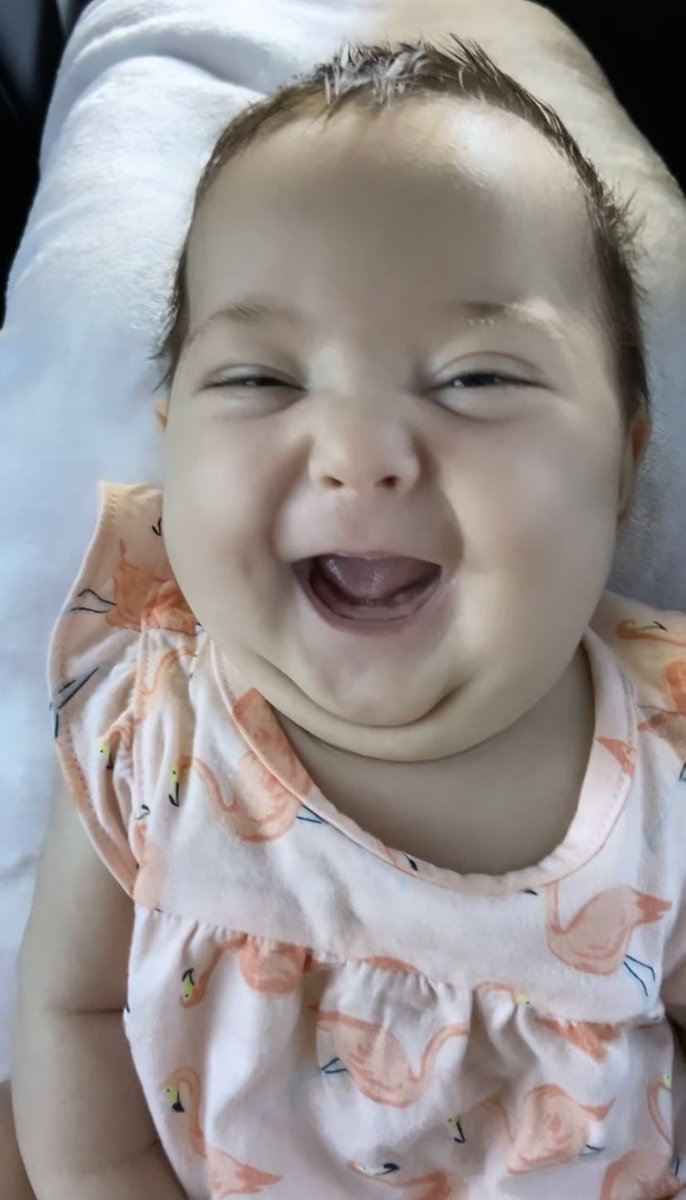 hopea___'s tweet photo. I have the most adorable two month old 🥺 cheeks &amp; chin for days 🤪 https://t.co/rQ7sbomTRP