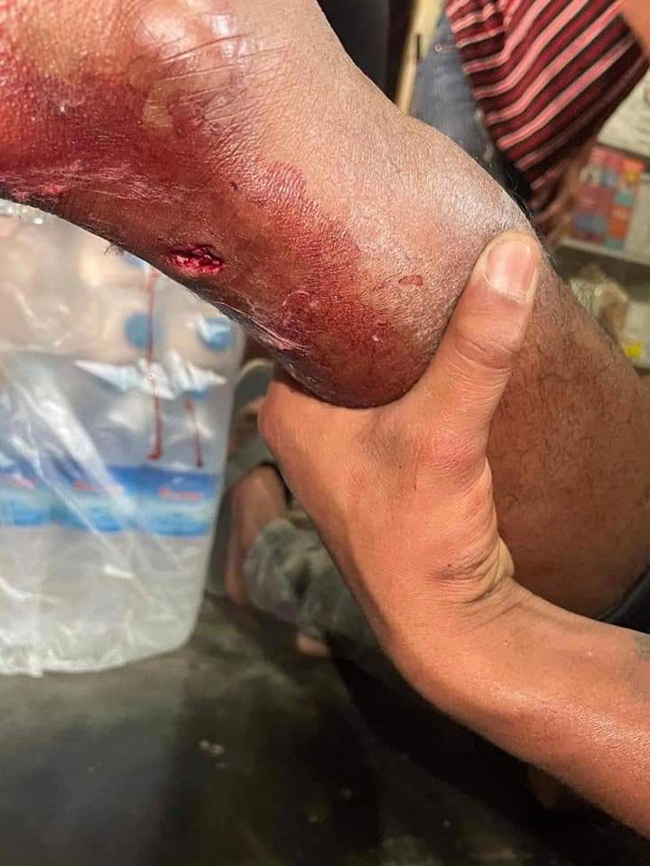 Bo_skateboard's tweet photo. tw// blood, gunshots
In #AungPan, terrorist groups shot 3 people at the moment.
One was thigh, one was leg and another one was hip.
At the AungPan, there's no internet and only poor wifi connections.

BLOODTHIRSTY JUNTA
#Mar15Coup 
#WhatsHappeningInMyanmar https://t.co/nSUxGvsdGa