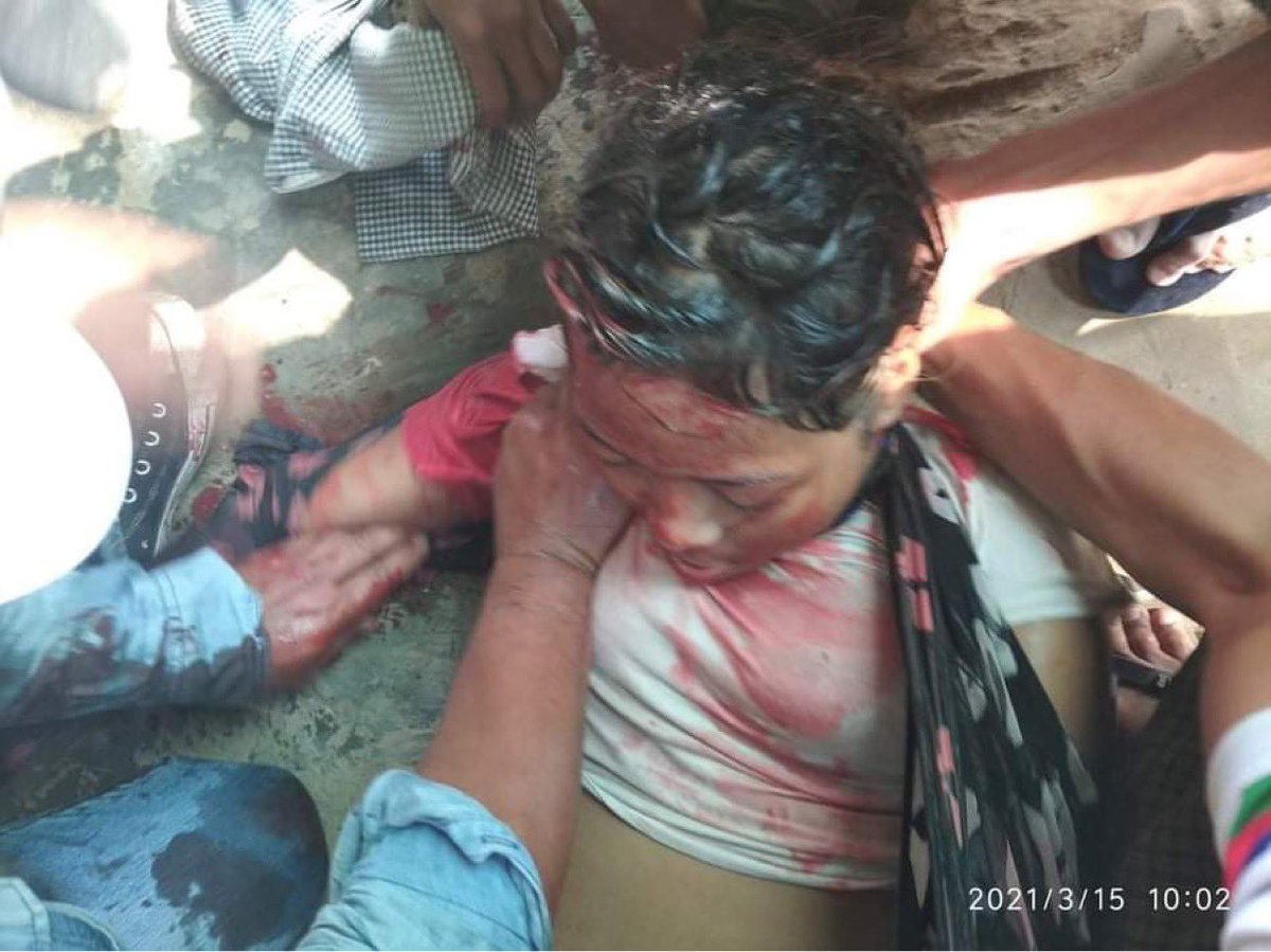 AyePyae21's tweet photo. Pan Myat Cheal 20 who was shot during a security force crackdown on anti-coup protesters in Myingyan, Mandalay region on Monday #WhatsHappeningInMyanmar
#March15Coup 
#MilitaryCoupInMyanmar https://t.co/VKk6pkjoMA