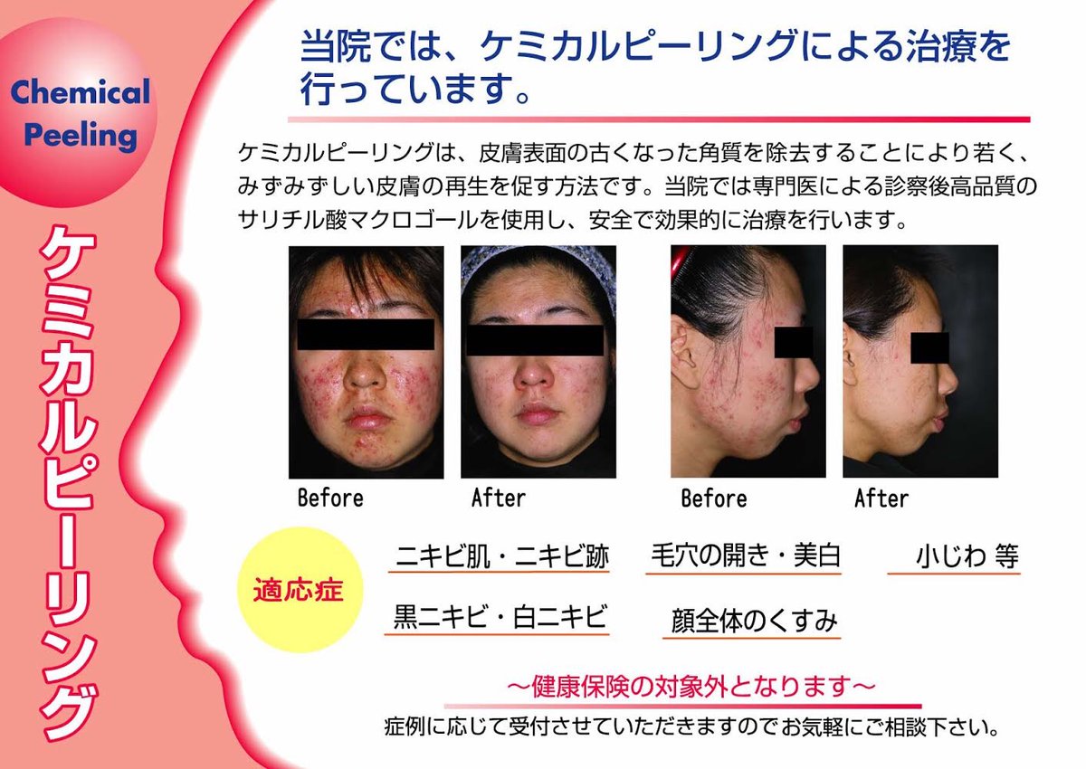 小杉町クリニック皮膚科形成外科 Kosugichoclinic Twitter