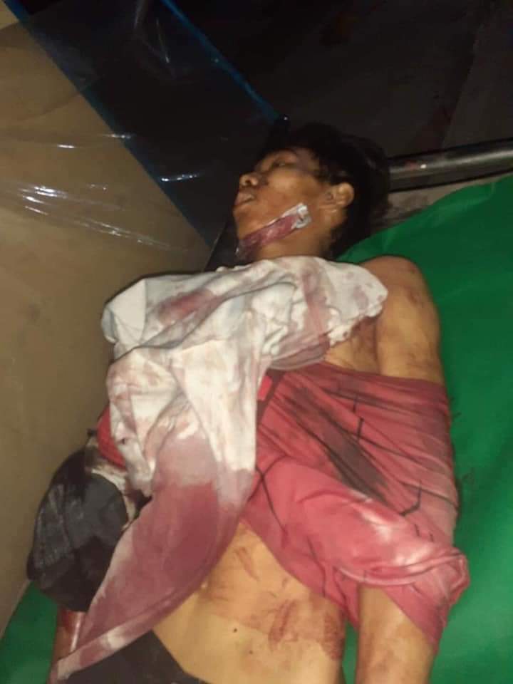 Tw // blood // wound // death

Bloody Day in Myanmar; At least 50 were mercilessly massacred only in Mar 14. All were brutally shot with live ammunitions n mostly shot in head. 7 civilians from #Thingangyun have fallen too.

BLOODTHIRSTY JUNTA
#Mar15Coup
#WhatsHappeningInMyanmar