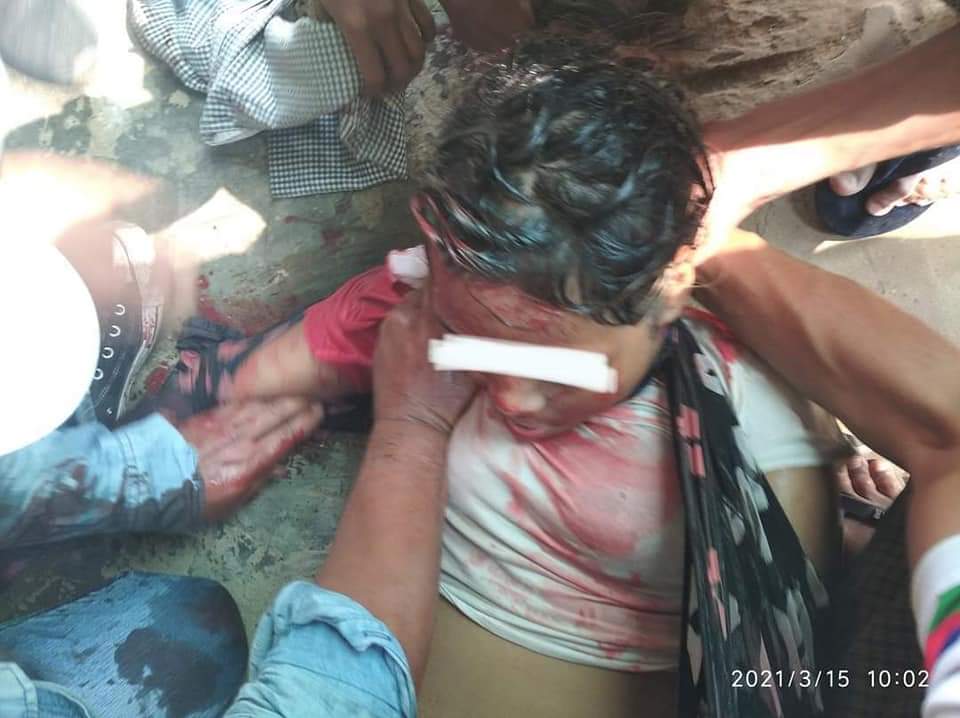 mayshooky's tweet photo. In Myingyan, Mandalay Region Myanmar Military terrorists cracked down the strike.Currently 2 were dead with headshot and several got injured.
tw // blood // gunshots// death

BLOODTHIRSTY JUNTA
#WhatsHappeningInMyanmar
#Mar15Coup https://t.co/xytNwB5ekw