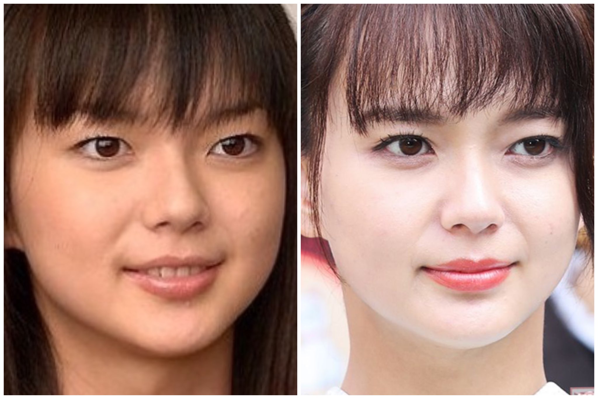 多部未華子の整形疑惑5選 目や鼻が変わって可愛くなった K Journal