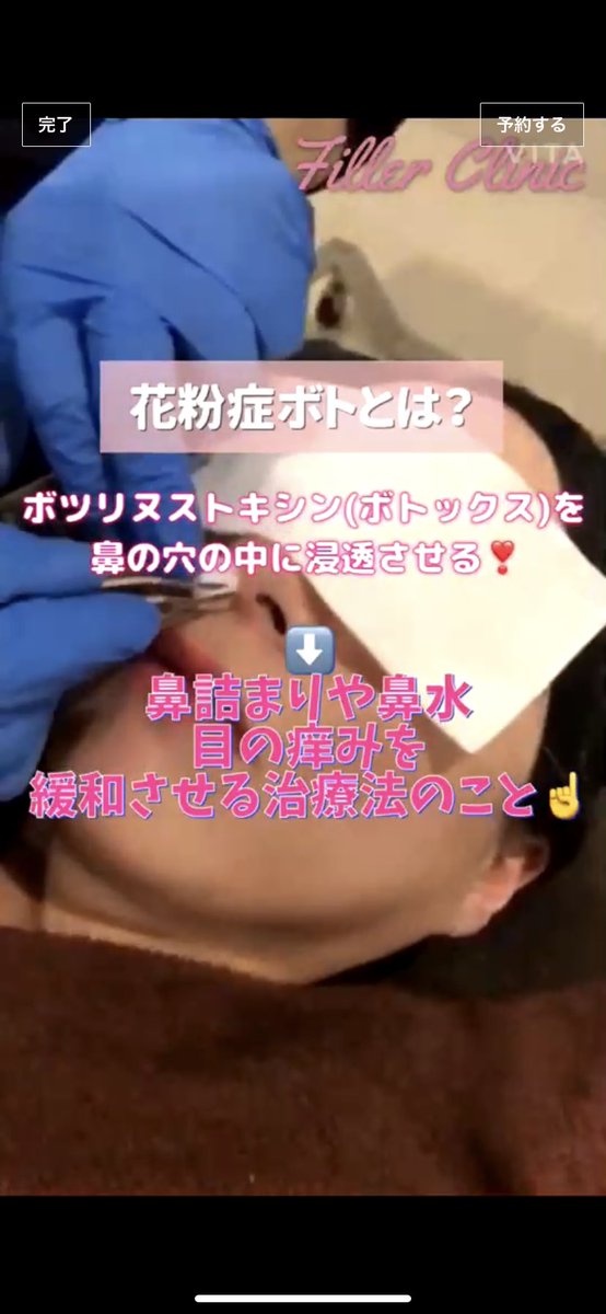 bybyby_ac's tweet photo. ボトックス花粉症にも使えるの？知らなかった。
ボトックス染み込ませたガーゼを鼻に詰めるだけだし、ワンシーズン1.2回の施術だし、1回5500円とかすげえ聞こえいいぞ。 https://t.co/VnAYy8JTn1