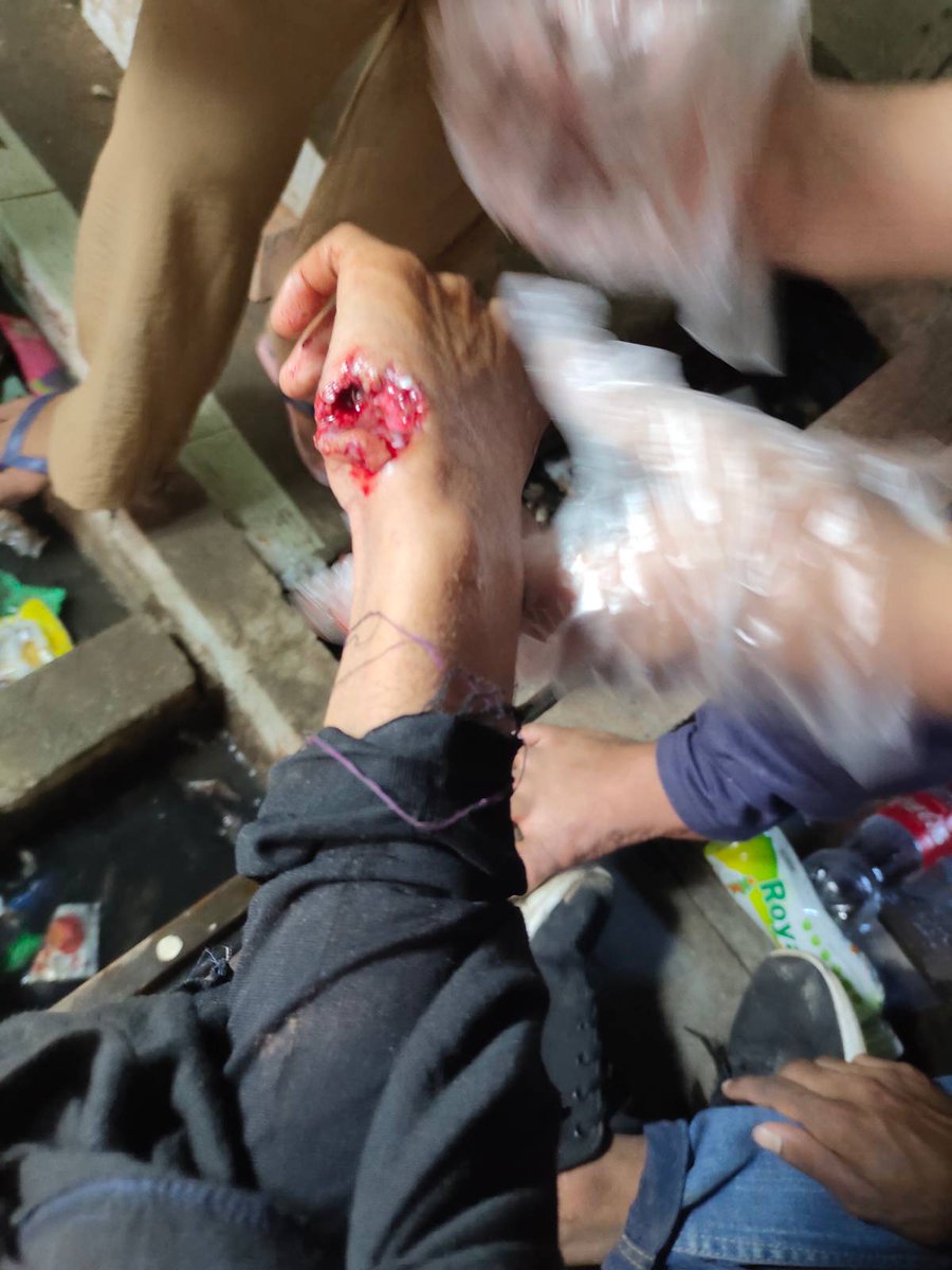A nurse with 8 years experience in #Yangon #Myanmar tells me wounds/injuries/deaths she's seeing is the worst she's ever encountered. Says wounds seen not accidental but intentional bullet shots. Adds gravity of cases means performing surgery at scene #WhatsHappeningInMyanmar