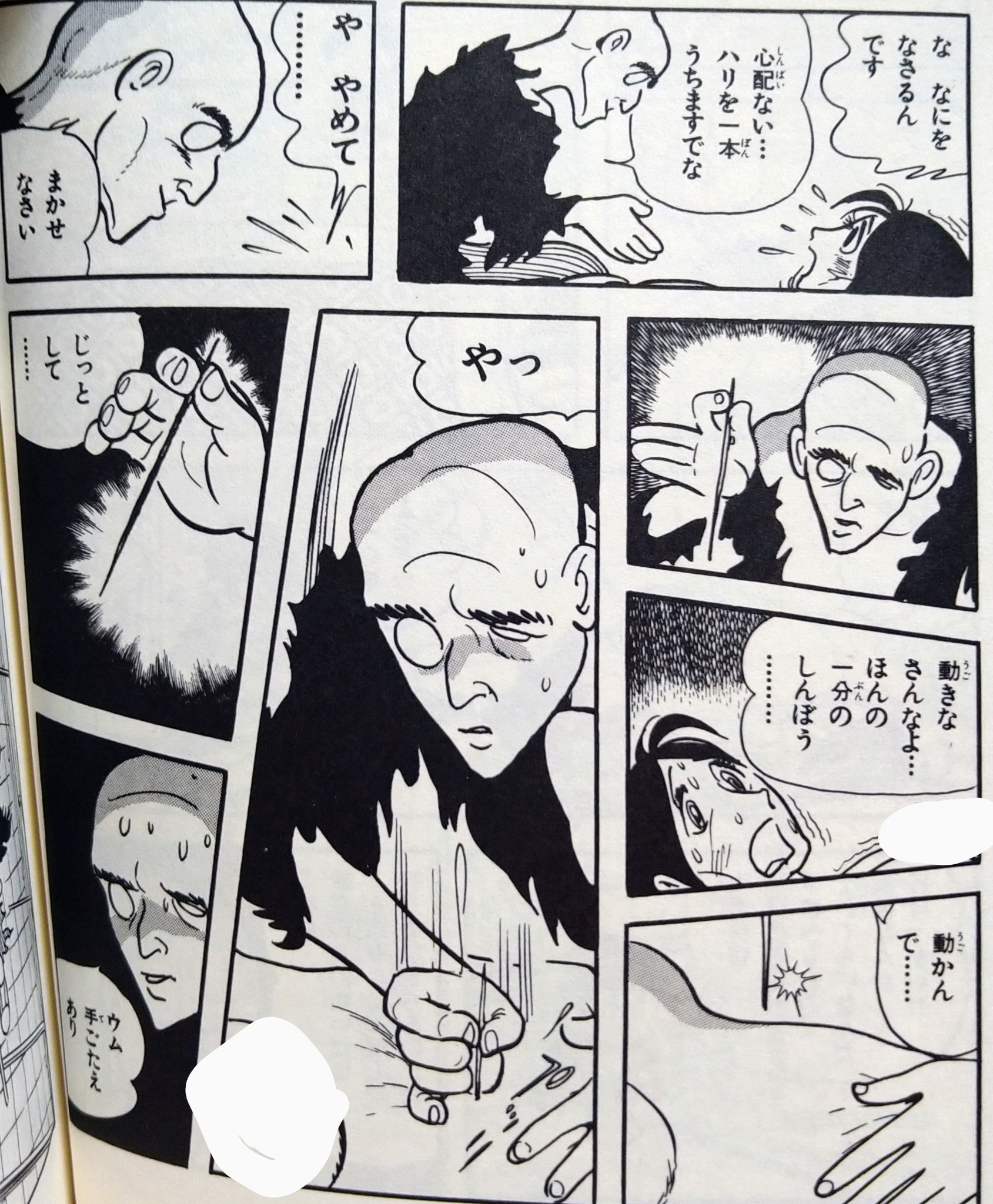 もぎす マンガの中の鍼灸 その1 ブラックジャック 無免許の鍼師を名乗る琵琶丸が鍼をします 外科手術に対するアンチテーゼな事を言うんですが 鍼も鍼で危険はあるよ というお話 ウム 手ごたえあり は 鍼灸師なら一度は言いたいセリフ 笑