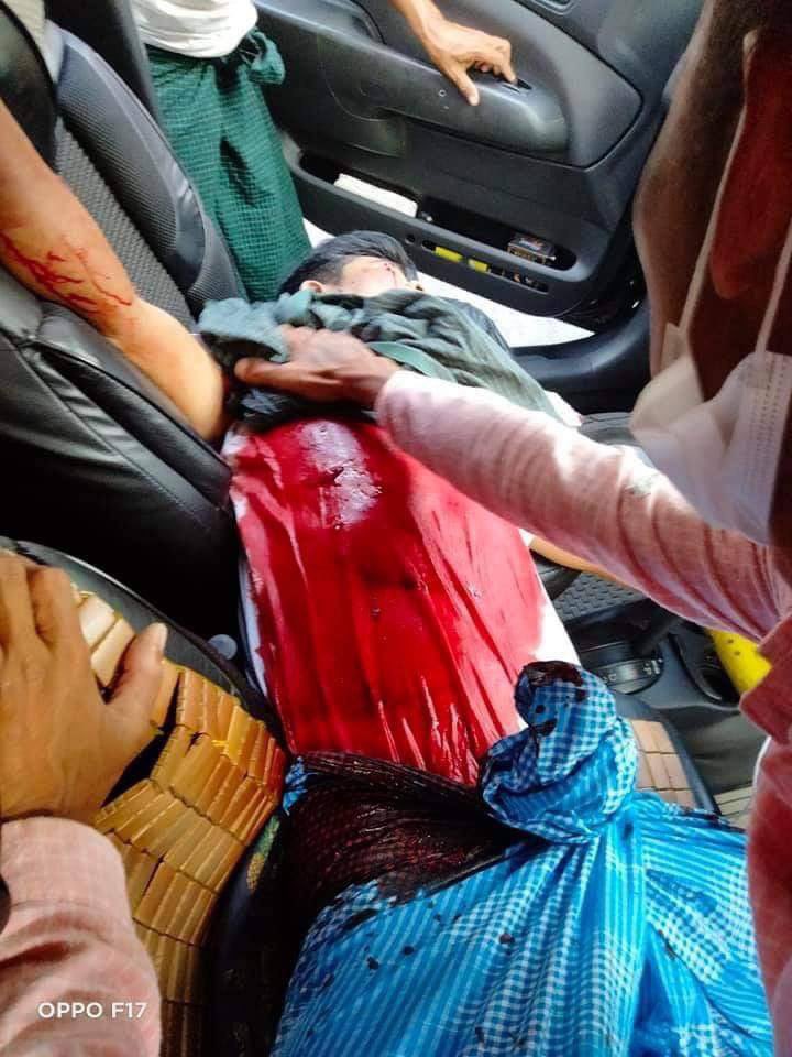 BG_ICEICE's tweet photo. A car passing by on BaYintNaung bridge was shot randomly by the military junta group. The driver of the car was seriously injured.
BLOODTHIRSTY JUNTA 
#Mar15Coup 
#WhatsHappeningInMyanmar https://t.co/fhDNEgVlOE