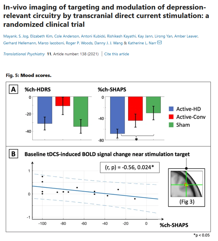SoterixMedical's tweet photo. First ever RCT exploring 4X1 HD-tDCS for Depression https://t.co/jFTkbPIVaf While no significant difference observed for HDRS between Active-HD,Active-Conventional,&amp; Sham, significant difference observed for SHAPS scale-a core feature of Depression #brainstim #neuromodulation https://t.co/bexnH2qFSN