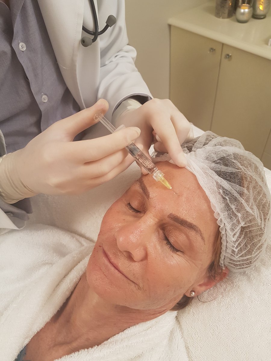 SkinBodyRenewal's tweet photo. HOW DOES REDERMALIZATION WORK?
Redermalization is the process of injecting a mixture of Hyaluronic Acid & Sodium Succinate using a special technique, to rejuvenate the skin.
But why this cocktail you may ask? https://t.co/IzbdigoXGi
#SkinRenewalSA #skin #beauty #redermalization https://t.co/50OIQszYNd