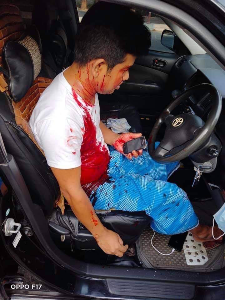 T3ss_KZ's tweet photo. @freya_cole Tw // blood

A car passing by on BaYintNaung bridge was shot randomly by the military junta group. The driver of the car was seriously injured.
BLOODTHIRSTY JUNTA 
#Mar15Coup 
#WhatsHappeningInMyanmar https://t.co/QOT8v2yYnl