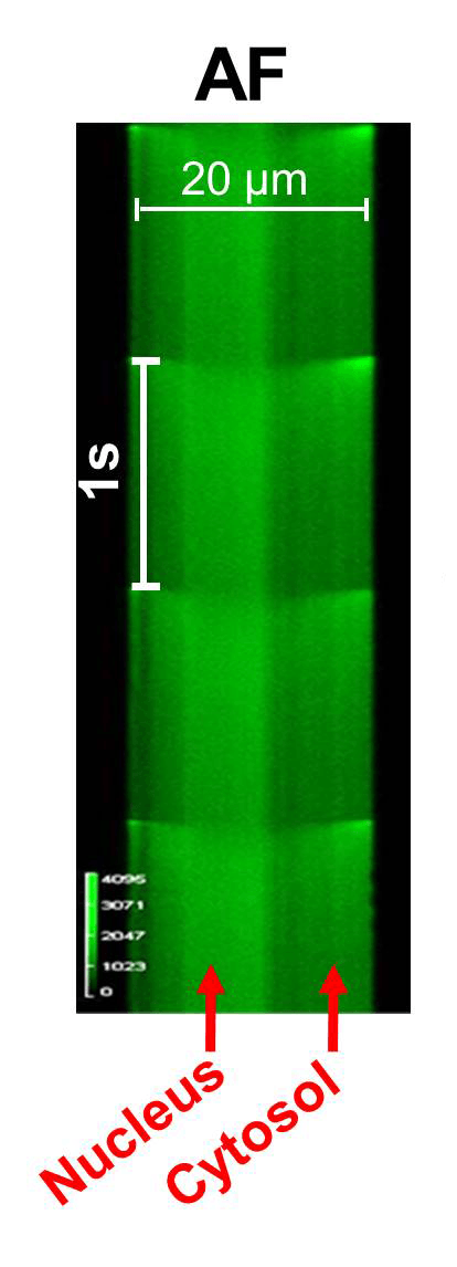 CircRes's tweet photo. Qi & colleagues found that #AtrialFibrillation caused nuclear Ca2+ overload through upregulation of #IP3R signaling. Learn more about how reduced #miR26 in atrial #cardiomyocytes leads to enhanced nucleoplasmic Ca2+ handling https://t.co/2rM8Pim6Hq
@JordiHeijman https://t.co/xztKezOiIR