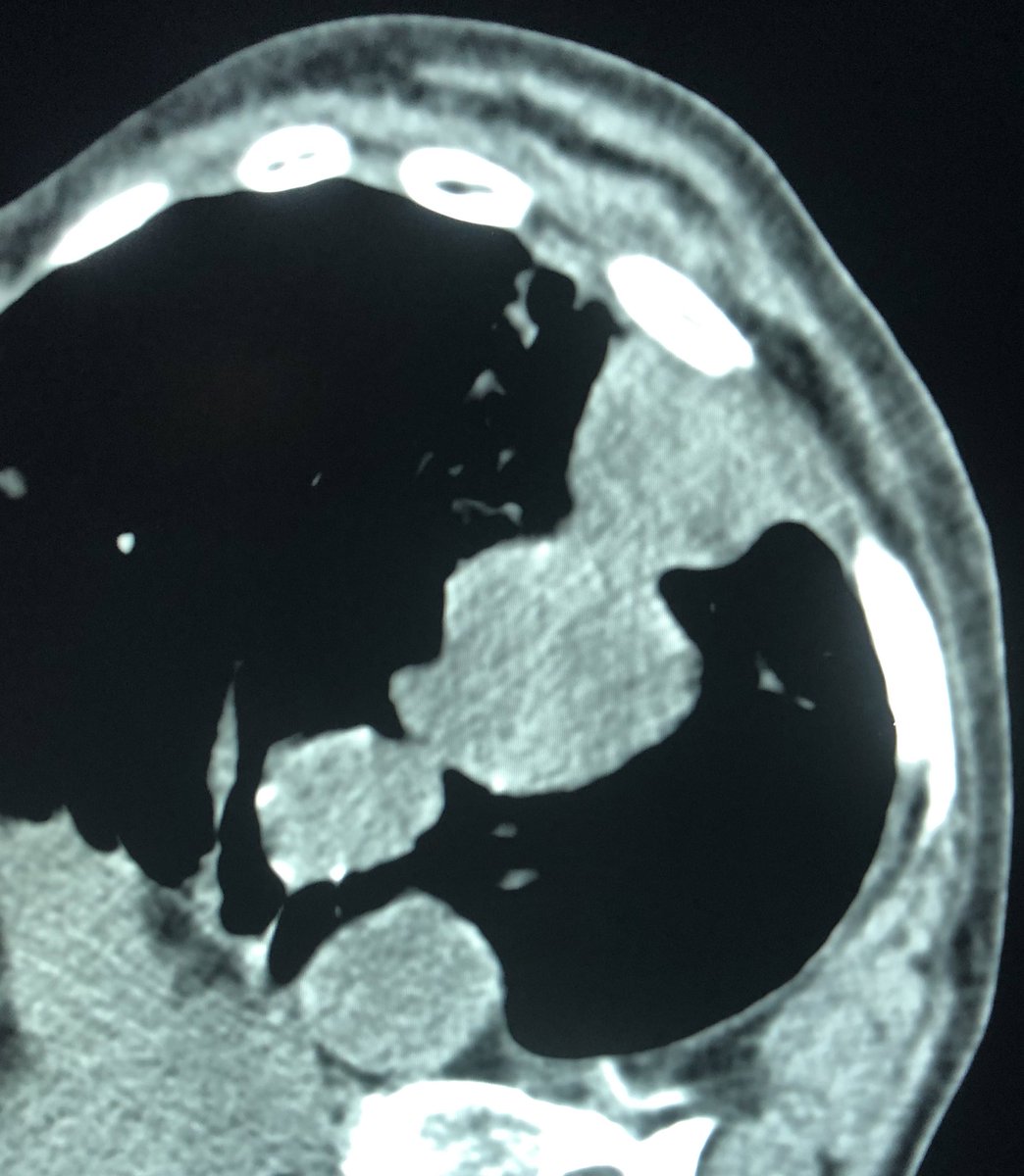 zachary masi tweet media