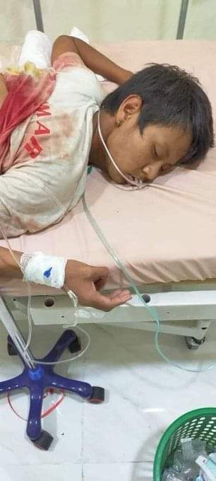 This is not cracking down on strikes ...
This is pro-democracy civilians are being genocide.‼️
#RejectMilitaryCoup 
#WhatsHappeningInMyanmar 
#SaveMyammar 
#MilkTeaAlliance 
#UrgentInterventionInMyanmarNeeded 
#UN